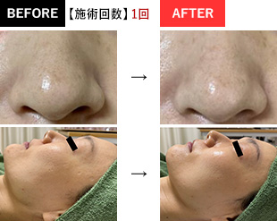 BEFORE→AFTER