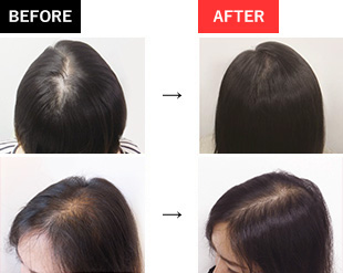 BEFORE→AFTER