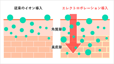 従来のイオン導入とエレクトロポレーション導入の違い